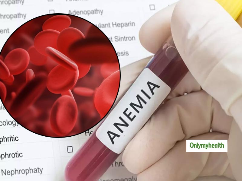 1 in 4 People Have Anaemia Worldwide, Rates Fall Only For Men: Lancet Study
